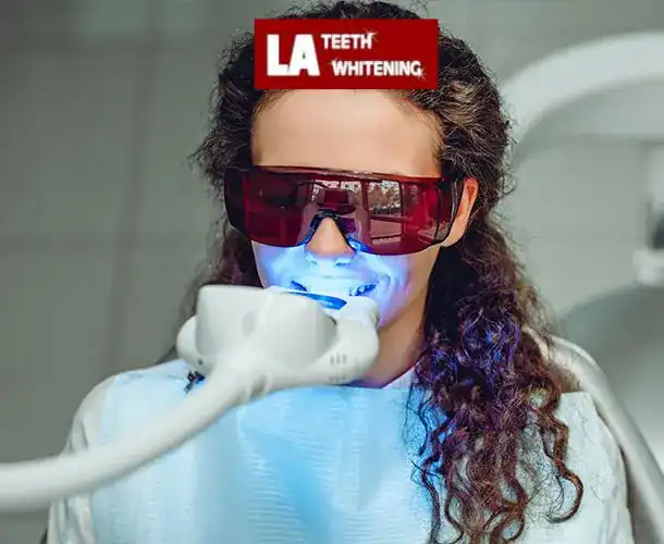 Teeth Whitening Laser Method Crawley Crawley